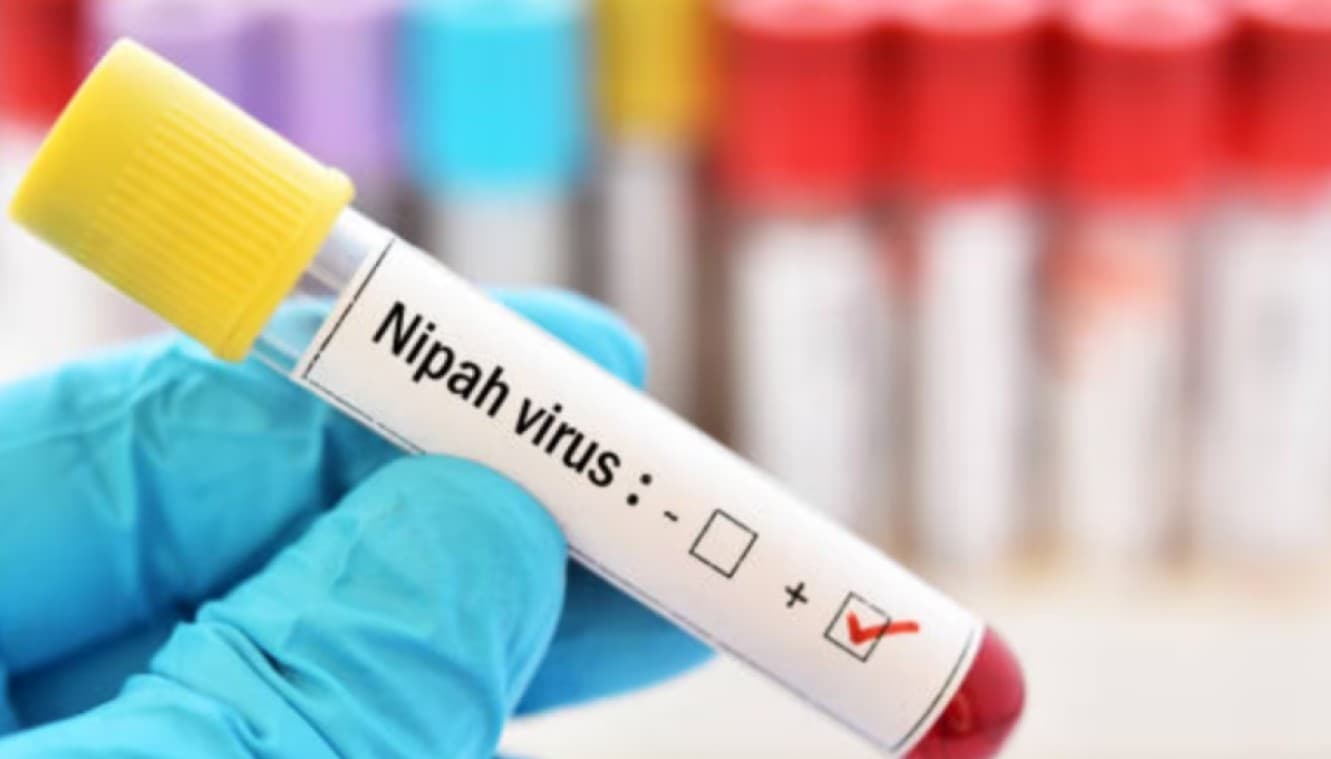 Asia Tightens Airport Checks After Nipah Virus Outbreak